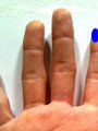人差し指や小指の先端（手の平側）